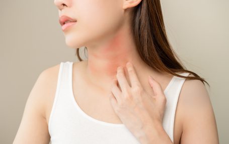 Tips for Managing Allergic Reactions