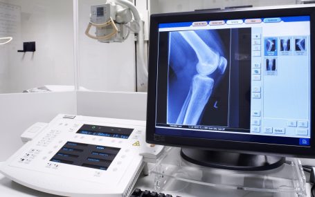Why Your Provider May Order an X-Ray Even Without a Major Injury