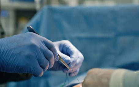 Do I Need Stitches? How to Tell When a Cut Needs Professional Care